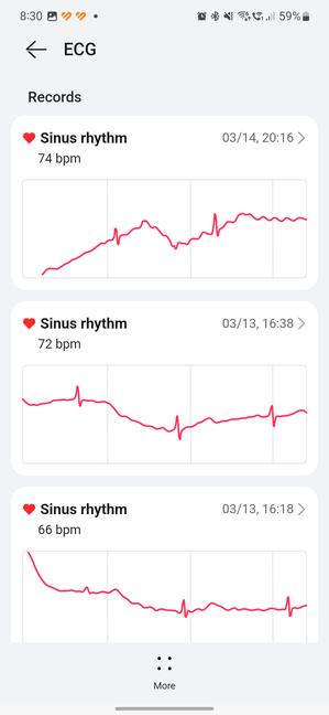 See your past ECG records